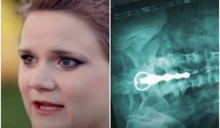 “Pânico”: Mulher passa por cirurgia após ficar com vibrador preso no reto